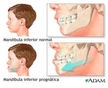 Hábitos orales de la infancia